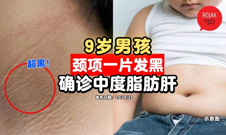 neck-black-body-checkup-fatty-liver-disease