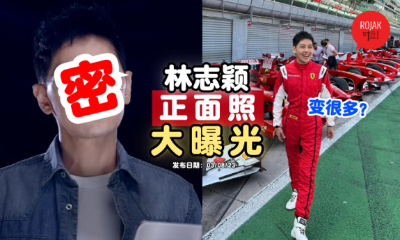 jimmy-lin-after-accident-back-to-work-condition