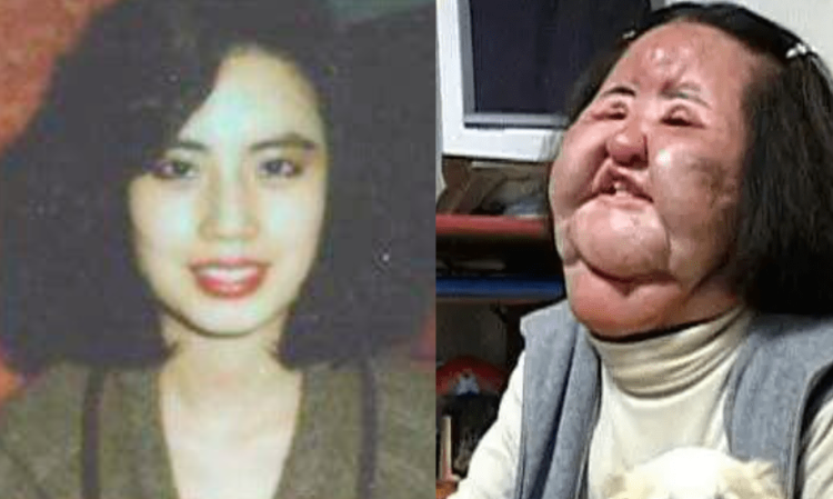 celebrity-plastic-surgery-disaster
