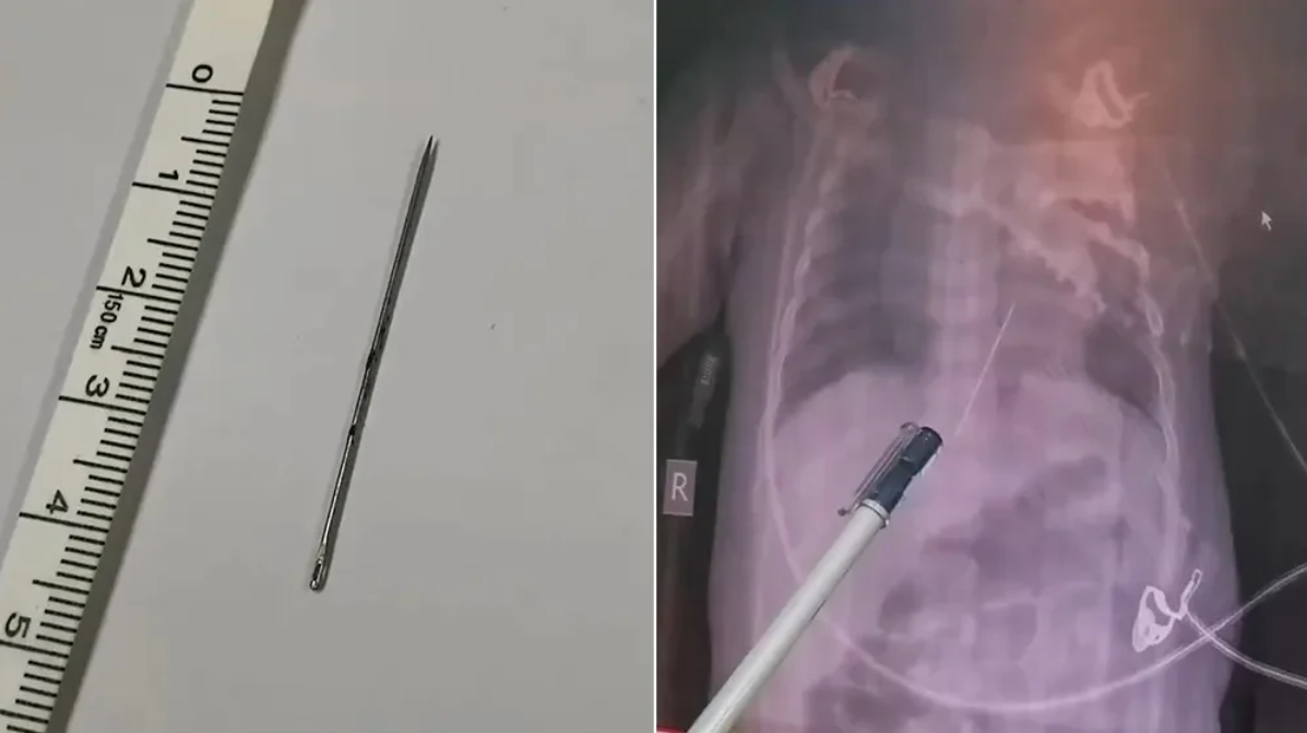 baby-body-inside-4cm-needle
