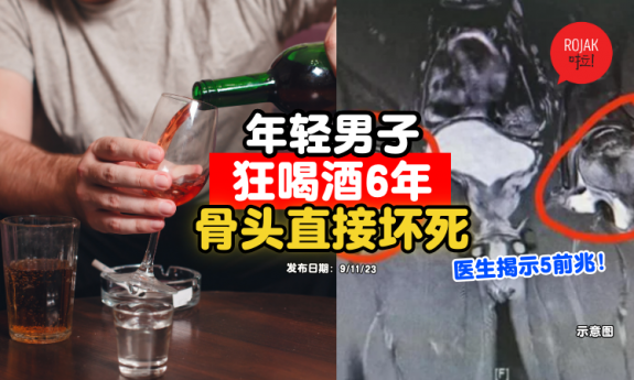 drink-alcohol-6-years-man-bone-problem