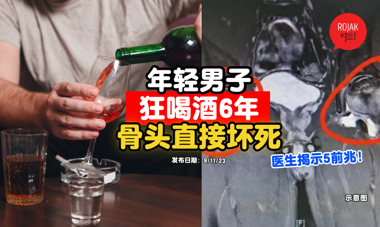 drink-alcohol-6-years-man-bone-problem