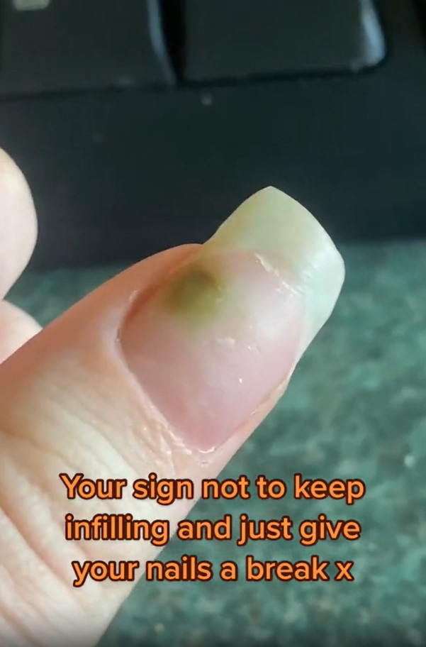  manicure-2months-green-bacteria