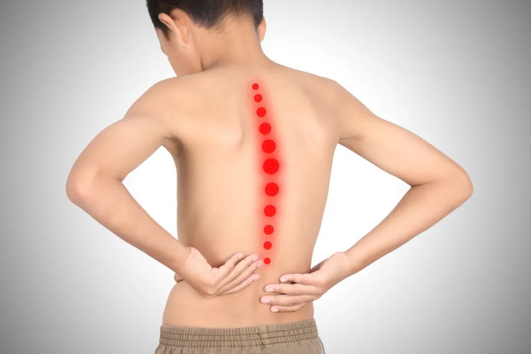 Chinese-Massage-Therapy-tuina-Scoliosis-worst