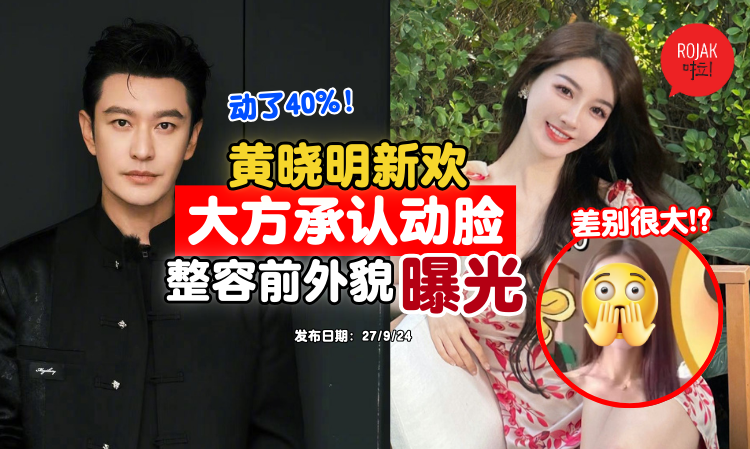 huangxiaoming-girlfriend-plastic-surgery-