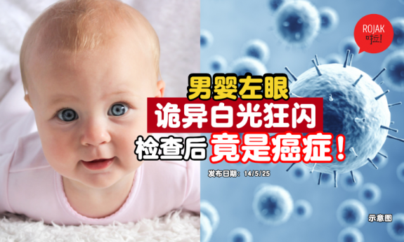 kid-eyes-white-glow-cancer-