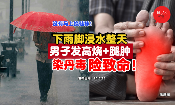 rainy-days-foots-wet-virus