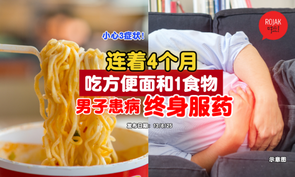 instant-noodle-snacks-Ulcerative-colitis