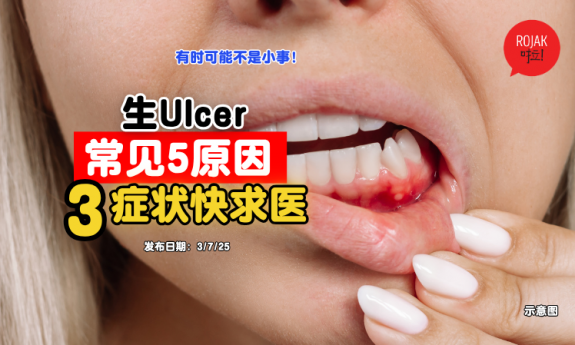 ulcers-reason-3-symptoms-careful-
