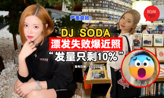 DJ-soda-hair-current-condition-