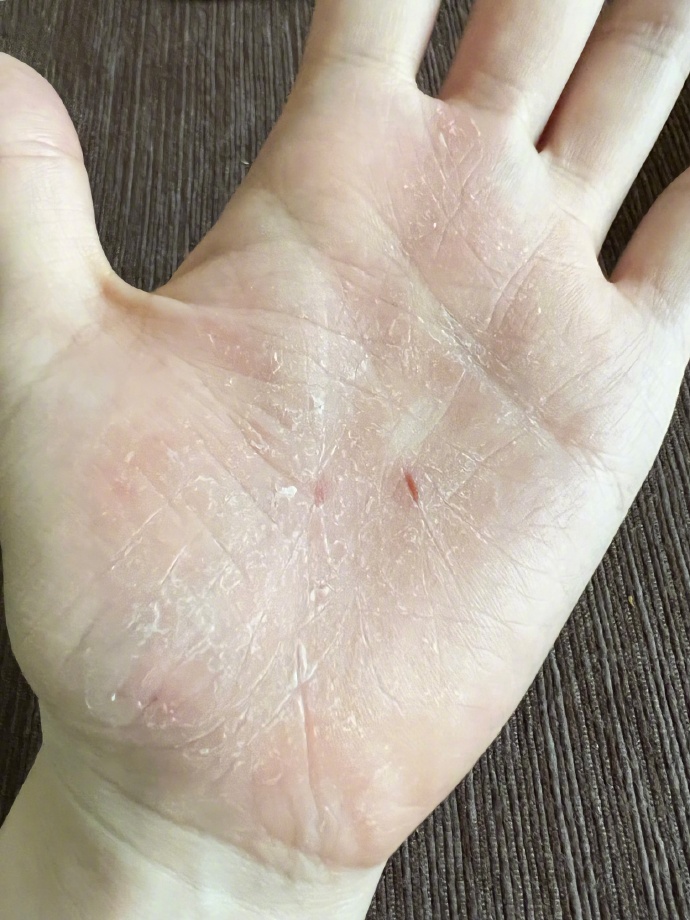 JaneZhang-health-condition