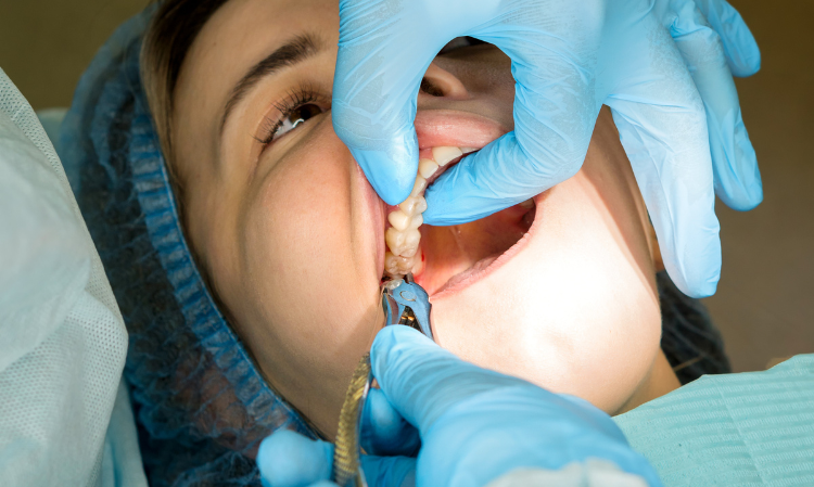 tooth-extract-Ice-compress-saman