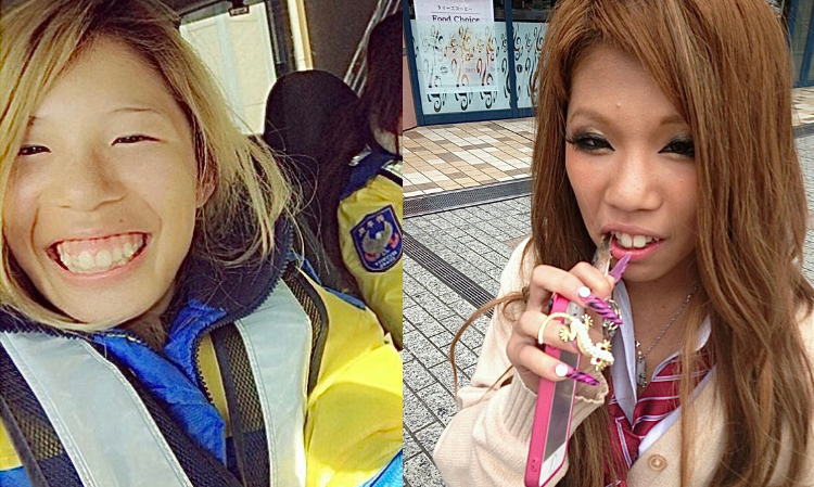 plastic-surgery-become-beauty