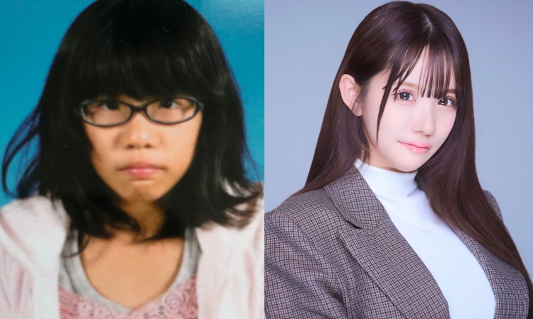 plastic-surgery-become-beauty