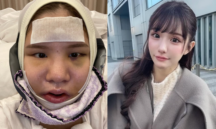 plastic-surgery-become-beauty