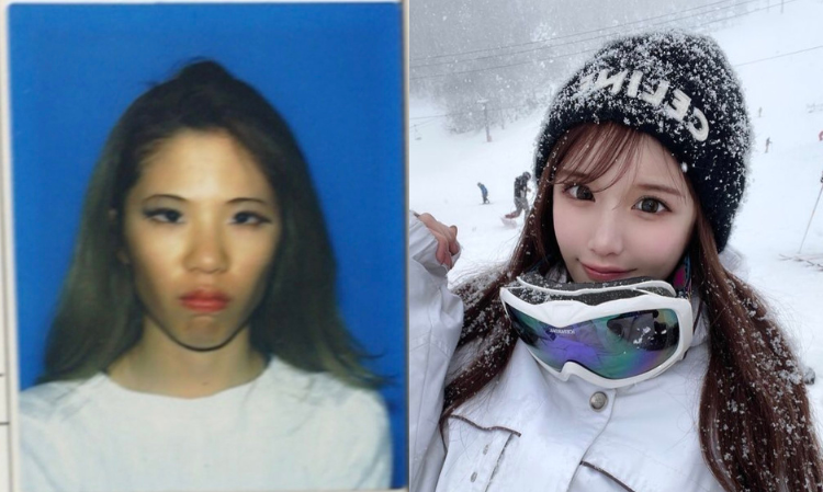 plastic-surgery-become-beauty-