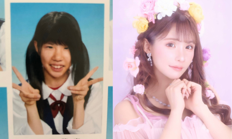 plastic-surgery-become-beauty