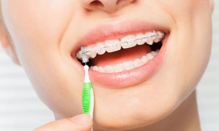 wear-braces-clean-teeth-well-