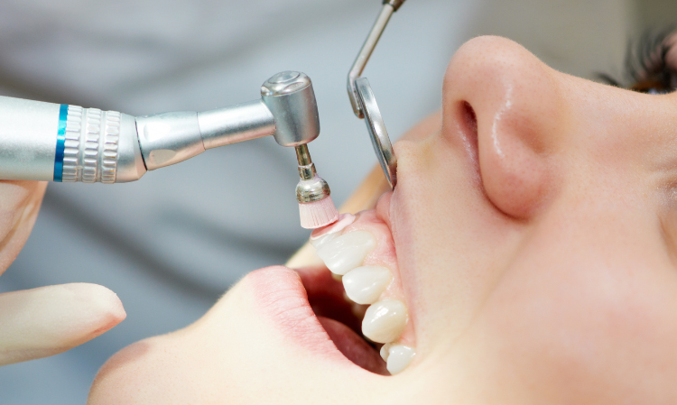 wear-braces-clean-teeth-well