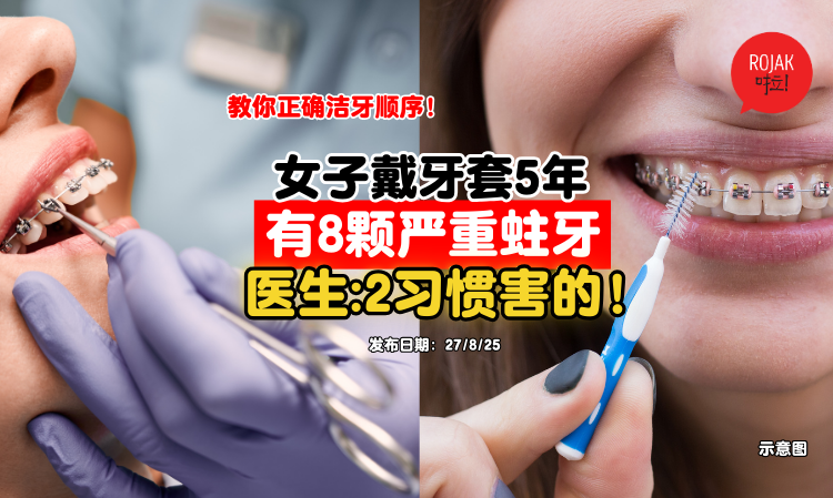 wear-braces-clean-teeth-well
