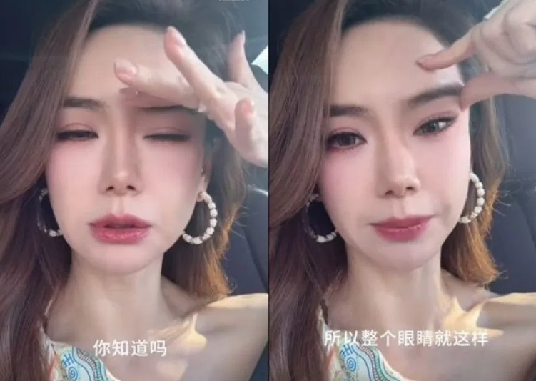 qiwei-botulinum-toxin