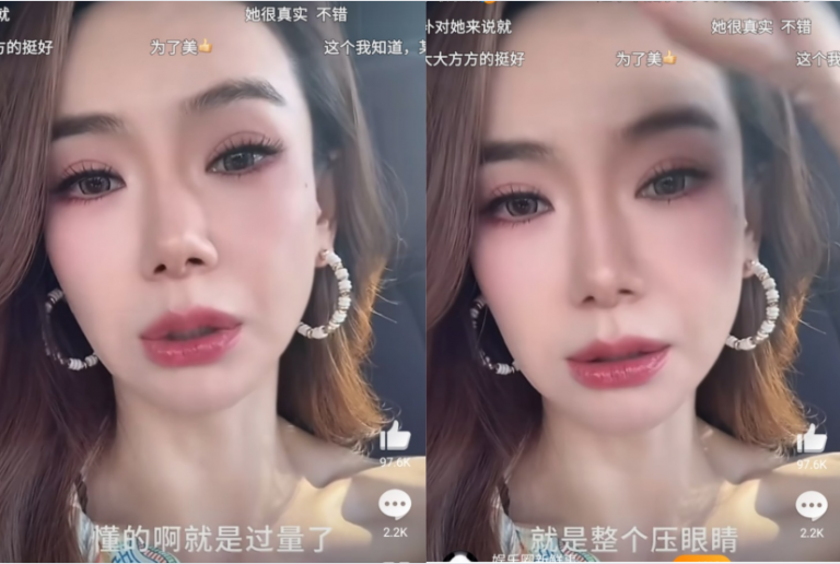 qiwei-botulinum-toxin