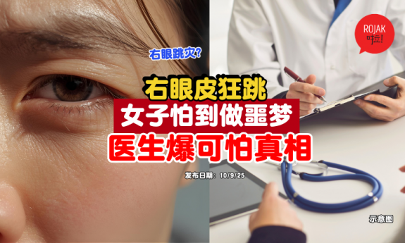eye-lip-jump-Facial-nerve-paralysis