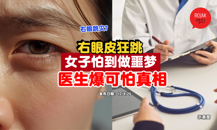 eye-lip-jump-Facial-nerve-paralysis