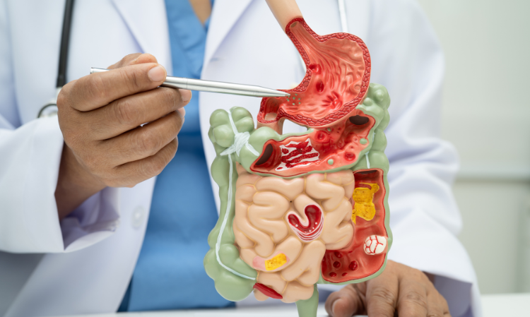 instant-noodle-Stomach-cancer