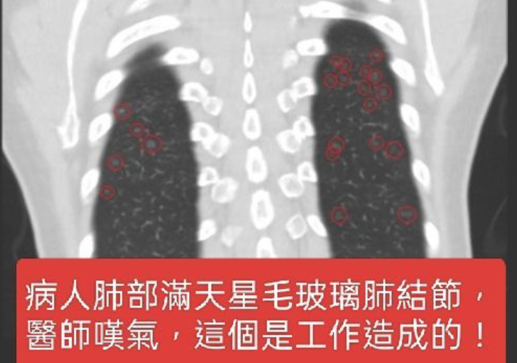 shoemaking-industry-affect-lung-healthy