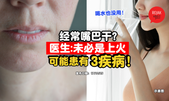 dry-mouth-maybe-sick-symptoms