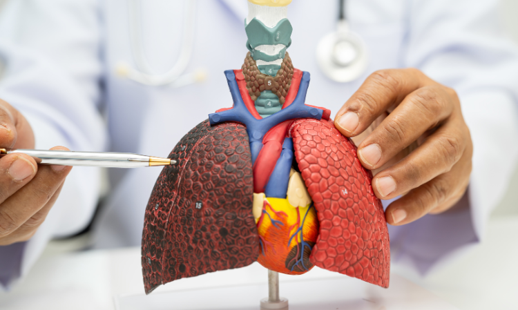 old-man-lung-cancer-1-way-selfcure