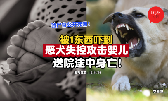 baby-attacked-by-dog