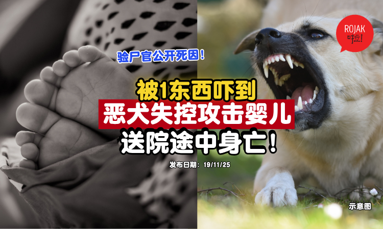 baby-attacked-by-dog
