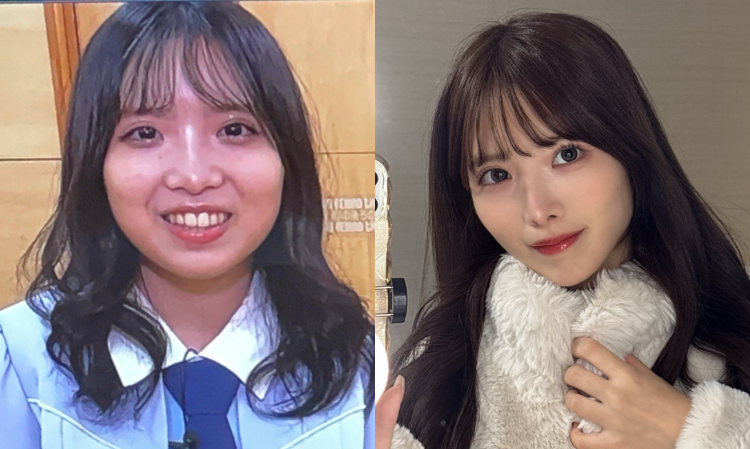 Japanese-idol-plastic-surgery