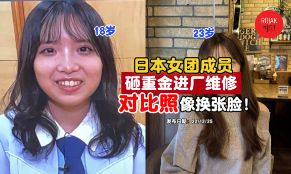 Japanese-idol-plastic-surgery