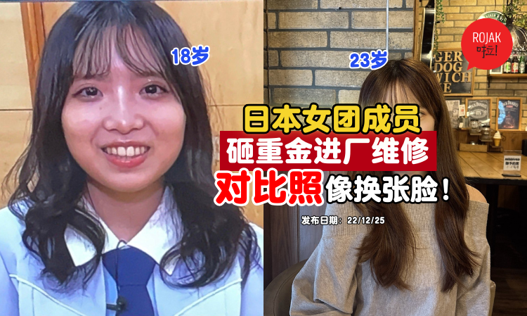 Japanese-idol-plastic-surgery