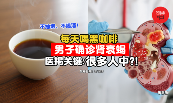 drink-black-coffee-1-reason-Kidney-Failure