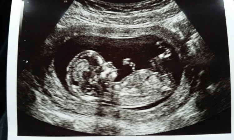 stomach-pain-half-an-hour-became-mother