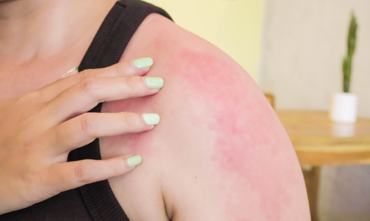 breast-cancer-12-symptoms
