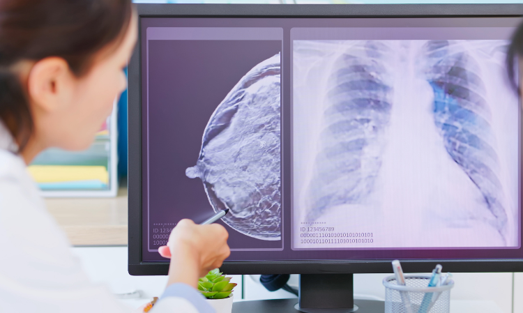 breast-cancer-12-symptoms