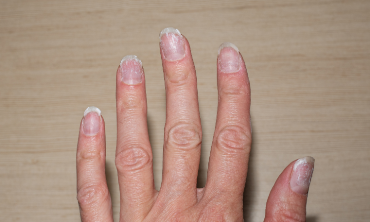 nails-with-white-line