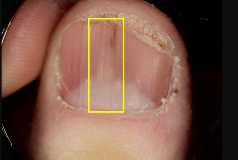 nails-with-white-line