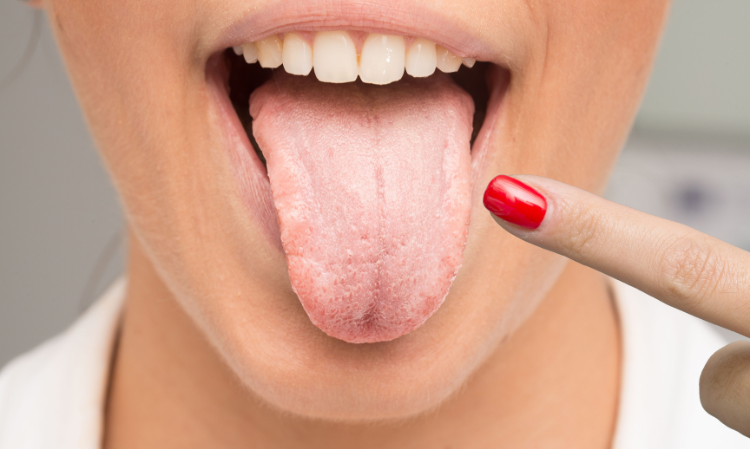 bad-breath-despite-brushing-reason