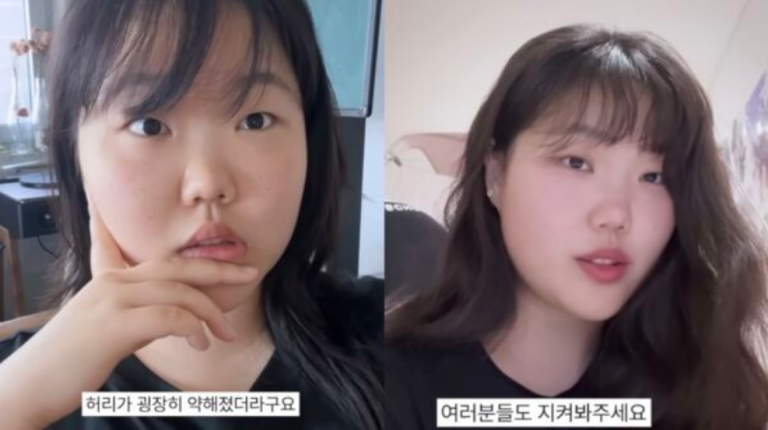 akmu-suhyun-diet-30kg-