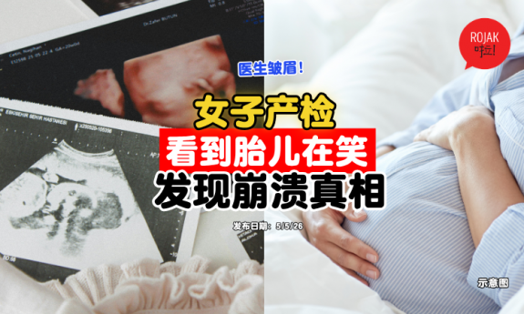 prenatal-check-up-baby-smile-
