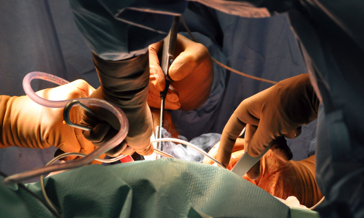 operation-doctor-mistake-patient-dead