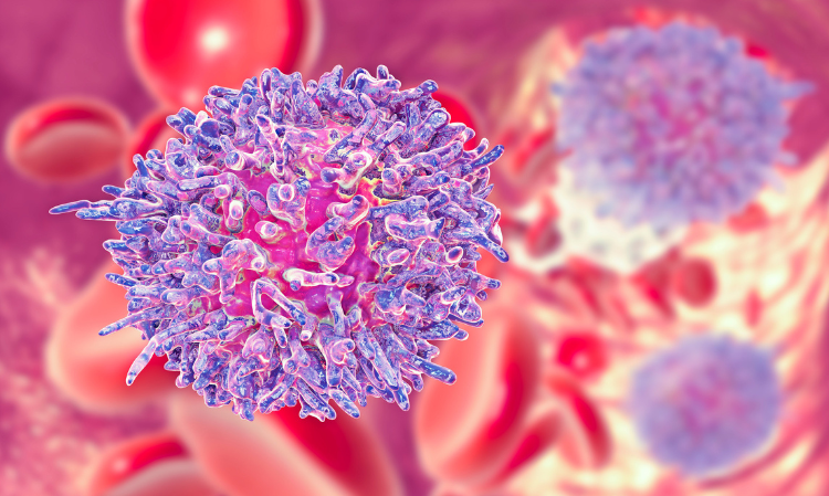 6-ways-to-avoid-yourself-from-getting-leukemia