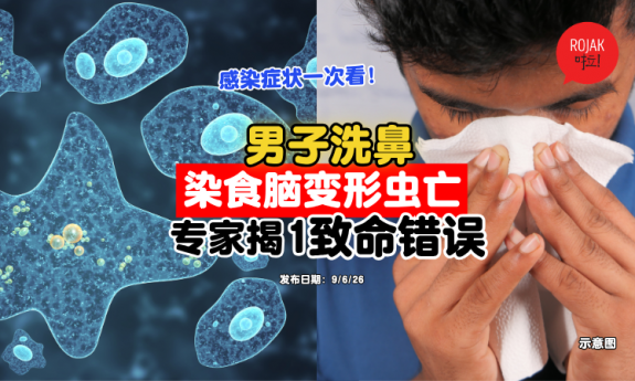 Rinsing-the-nose-with-tap-water-
