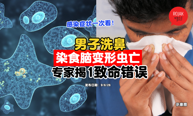Rinsing-the-nose-with-tap-water-
